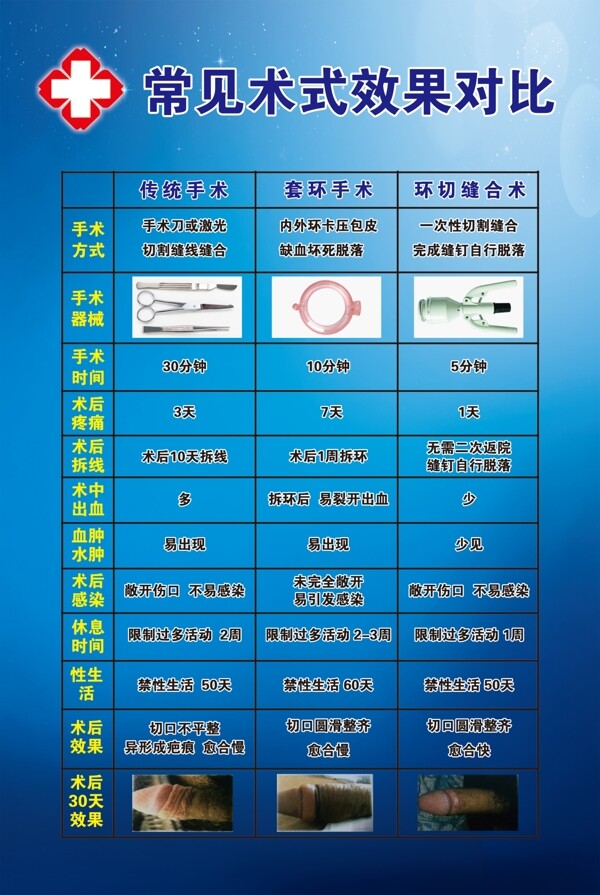 包皮切割器術(shù)式效果對比