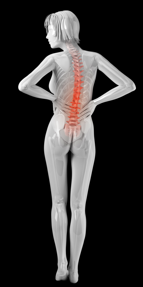 女性腰椎X光图像图片