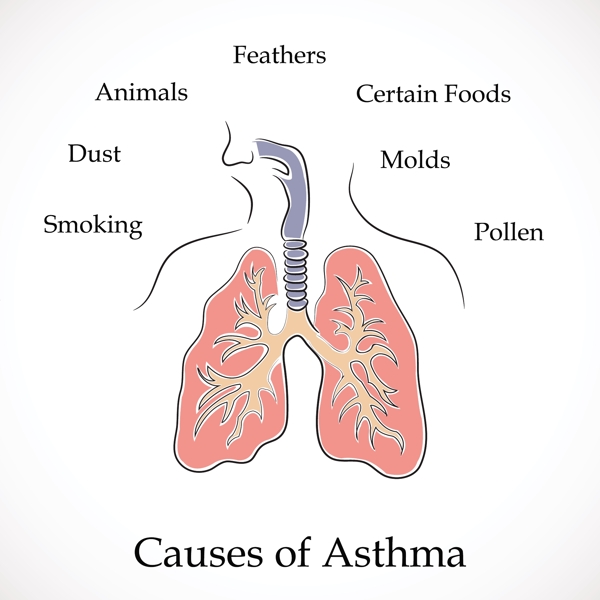 哮喘矢量世界哮喘日的原因