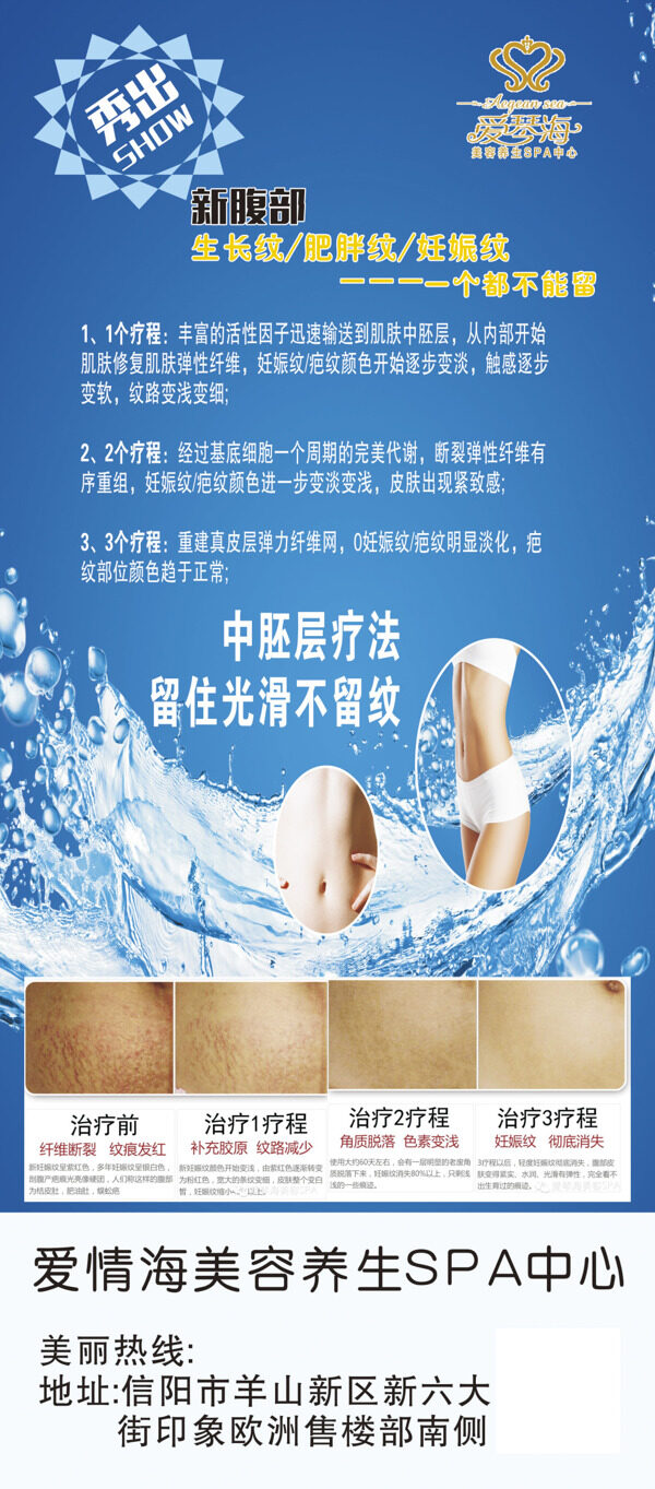 美容行業(yè)修復(fù)各種細紋的展架