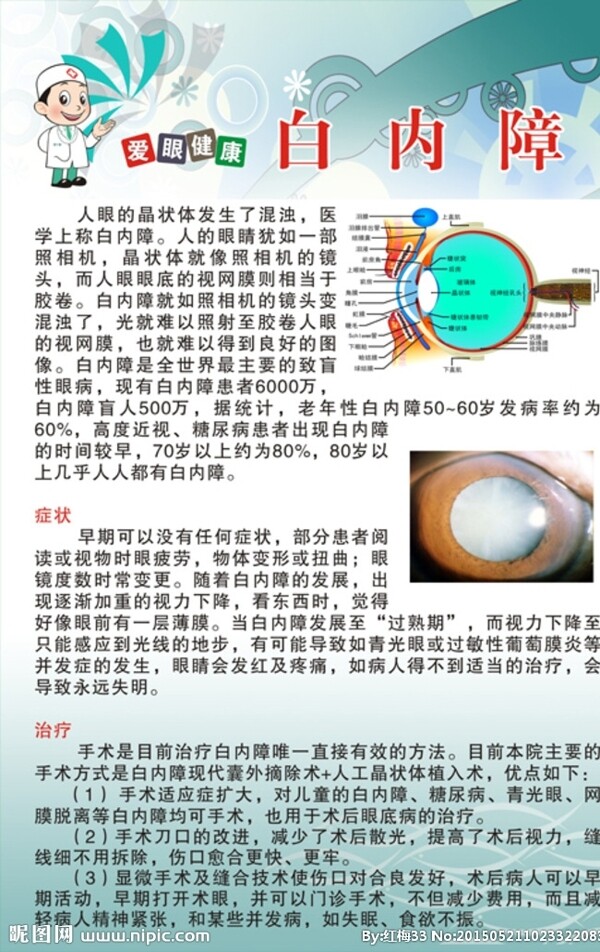 白內(nèi)障圖片