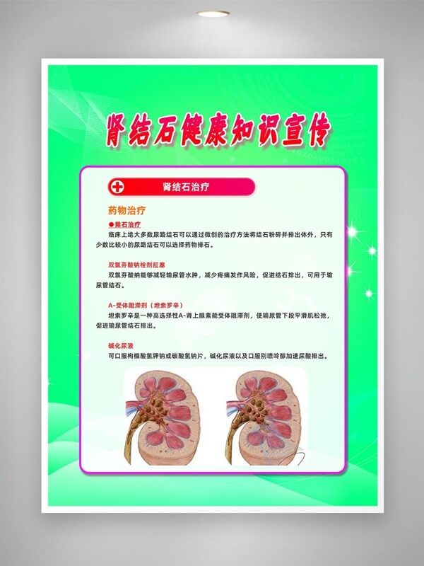 腎結(jié)石藥物治療知識(shí)宣傳海報(bào)