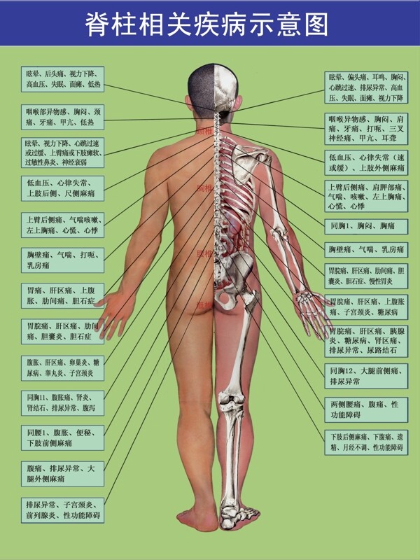脊柱相关疾病示意图图片