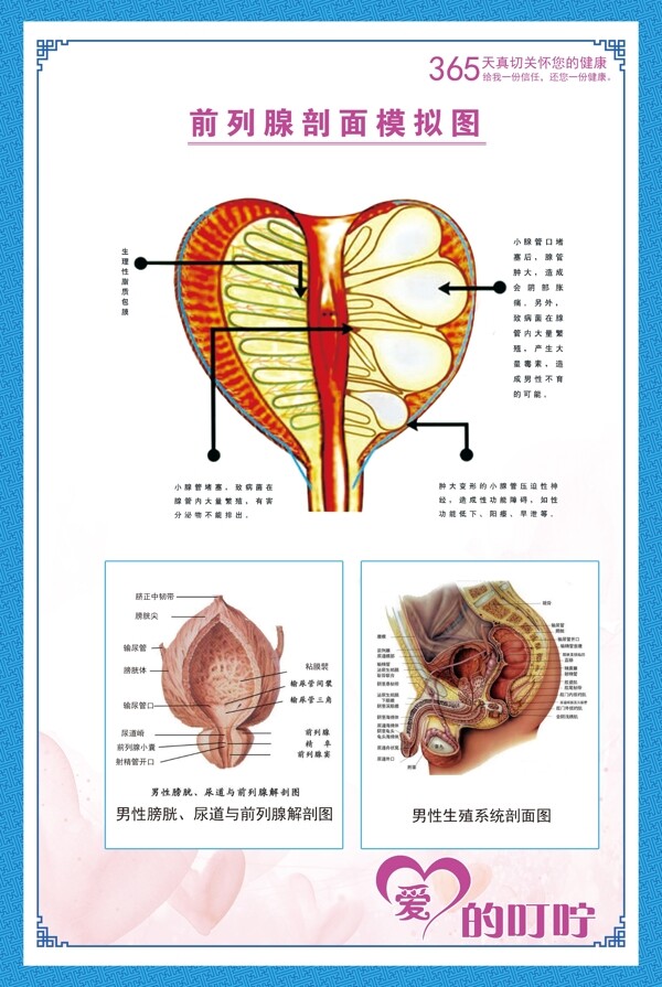 前列腺剖面示意图