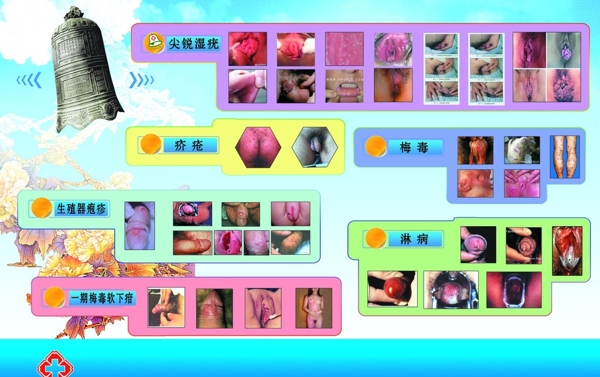 性病防治中心科普展板图片