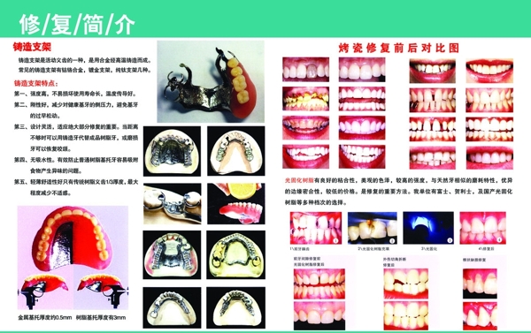 牙科展板图片