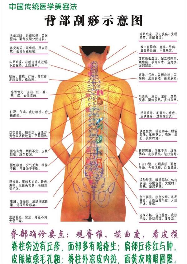 背部刮痧示意图图片