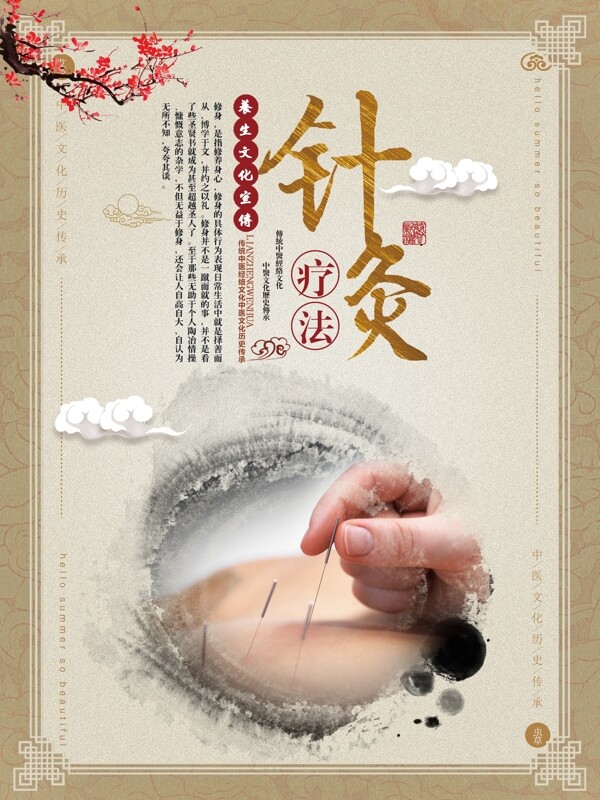 中国风中医针灸疗法宣传挂画设计