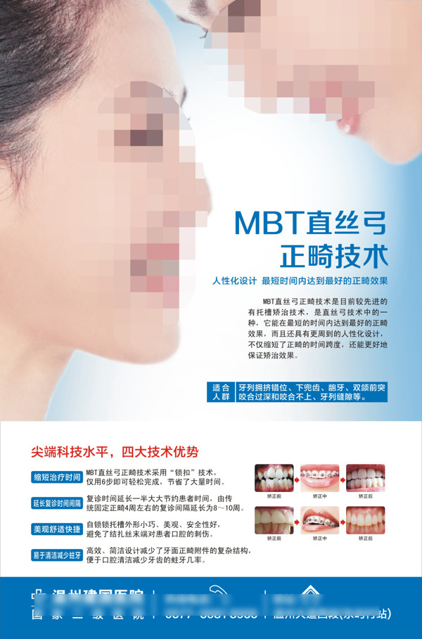 MBT直丝弓正畸技术