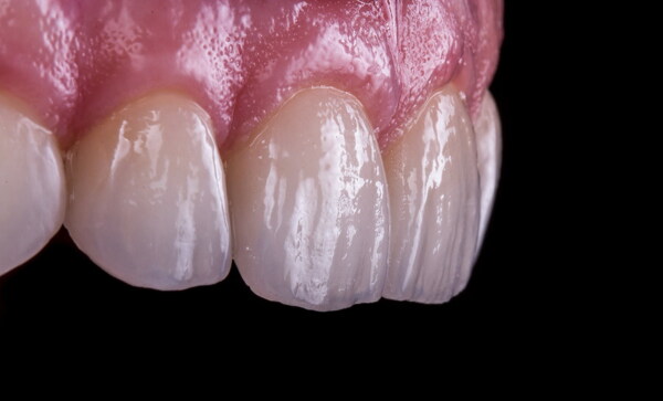 口腔牙齿结构